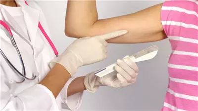 ماهي شريحة الامبلانون لمنع الحمل؟