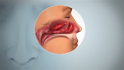 حاسة الشم هي المفتاح للكشف المبكر عن مرض الزهايمر