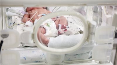 ولادة طفل بعين واحدة.. ظاهرة نادرة تثير تفاعلًا واسعًا على السوشيال ميديا