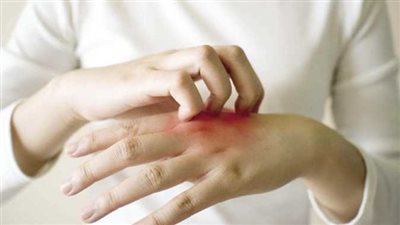 طرح لقاح مذهل للحزام الناري 