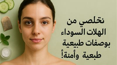 كيف تتخلّصين من الهالات السوداء بطرق طبيعية؟