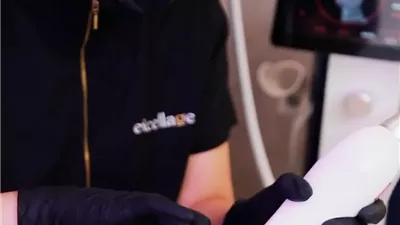 دراسة الوخز بالإبر الدقيقة Micro-needling يعزز الكولاجين بنسبة 40%