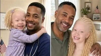 أنقذتُ طفلةً في الثالثة من عمرها في قسم الطوارئ حكايات حماده