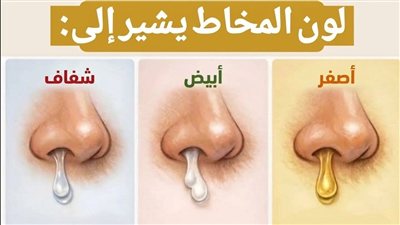 لون المخاط يشير إلى: دليل شامل لفهم إشارات الجسم