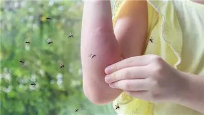 لدغات البعوض والقراد ليست مزعجة بل إنها تنشر أمراضًا خطيرة كيف تتجنبها 